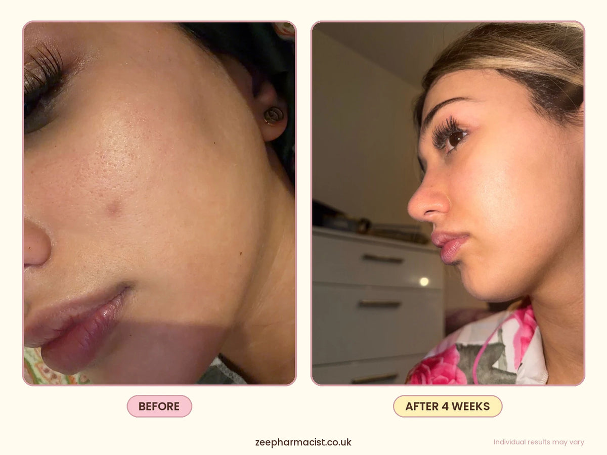 Dark Spot Treatment Serum