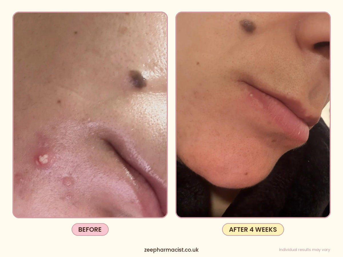Dark Spot Treatment Serum